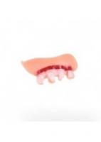 Гнилые зубы редкие